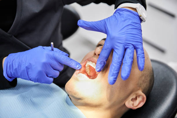 Best Teeth Whitening  in Las Animas, CO